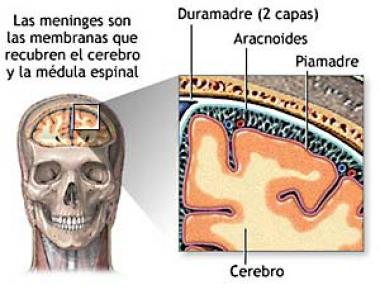 MENINGITIS MENINGOCÓCICA