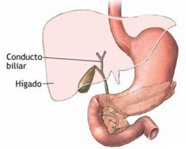 HIDROPESÍA VESICULAR