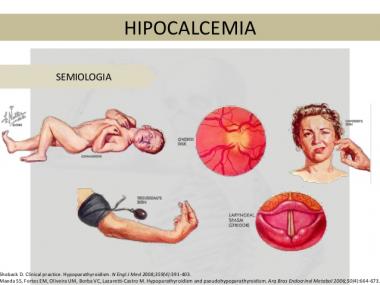 hypocalcemia