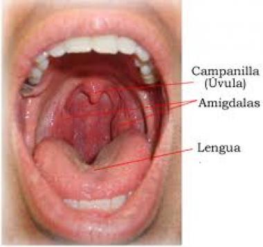 AMÍGDALA